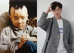 "Sao nhí số 1 showbiz" 14 tuổi đầu không còn 1 sợi tóc, khổ sở chịu đựng 300 mũi kim để cứu diện mạo