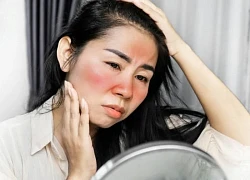 Những dấu hiệu cảnh báo từ làn da bạn không nên bỏ qua