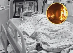 Vụ cha đốt con ở TN: diện tích bỏng của con trai lớn hơn mẹ, lộ loạt điểm rùng mình