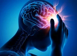 3 nguyên nhân chính gây thiếu máu não bạn cần biết