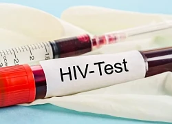 5 lợi ích của xét nghiệm HIV sớm trong thai kỳ