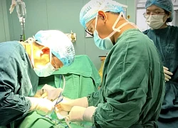 Nguy cơ liệt mặt, mù lòa từ u tuyến nước bọt ác tính