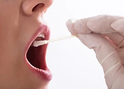 Phát hiện sớm nguy cơ mắc bệnh tim ở trẻ bằng cách lấy dịch vùng má?