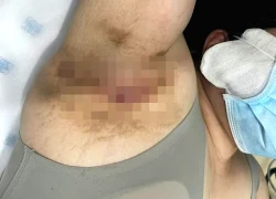 Một phụ nữ thoát được căn bệnh 'nhạy cảm' suốt 9 năm