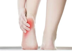 Biện pháp không dùng thuốc hỗ trợ giảm đau gót chân