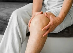 Dấu hiệu bất thường sau khi uống nước cảnh báo thận yếu