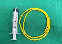 Gắp thành công dị vật dài 1 mét mắc kẹt trong bàng quang người đàn ông