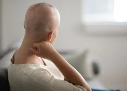 Giải pháp tiềm năng giúp bệnh nhân hóa trị hạn chế rụng tóc