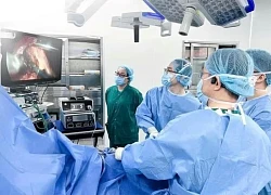 Lạm dụng thuốc lá làm tăng nguy cơ mắc ung thư phổi ở nam giới