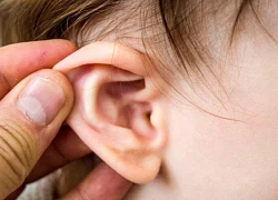 Viêm tai có gây điếc không?