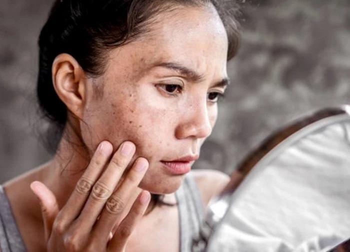 Bí quyết chăm sóc làn da khô khi mùa Thu đến