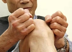 Thoái hóa khớp gối ở người cao tuổi: Cách chăm sóc và phòng ngừa hiệu quả