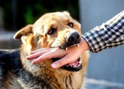 Bị chó lạ cắn, người đàn ông ở Đắk Lắk tử vong