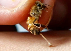 Chuyên gia hướng dẫn cách xử trí tai nạn do ong đốt