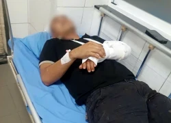 Điều tra làm rõ vụ một người đàn ông làm nghề cứu hộ giao thông bị đánh gây thương tích