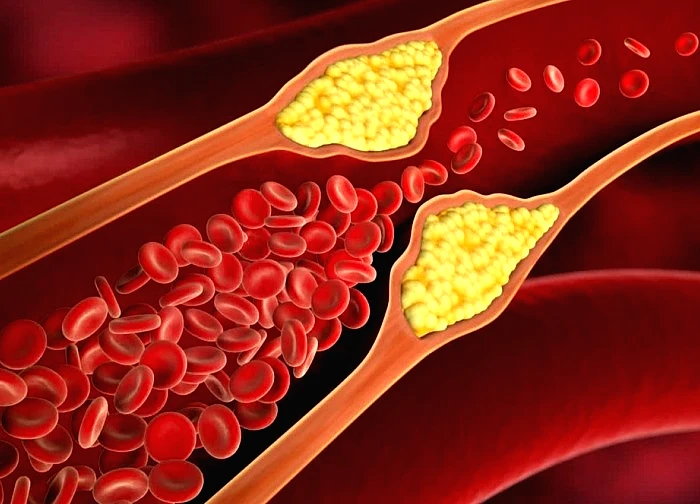 6 loại đồ uống khi bụng đói giúp giảm cholesterol xấu