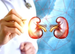 3 loại nước uống quen thuộc tốt cho thận