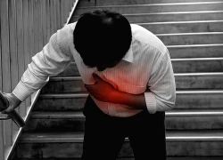 Cảnh báo nhồi máu cơ tim 'núp bóng' triệu chứng bệnh dạ dày
