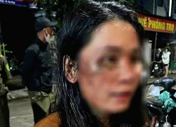 Công an vào cuộc vụ nữ nhân viên giao hàng tố bị khách đánh nhập viện