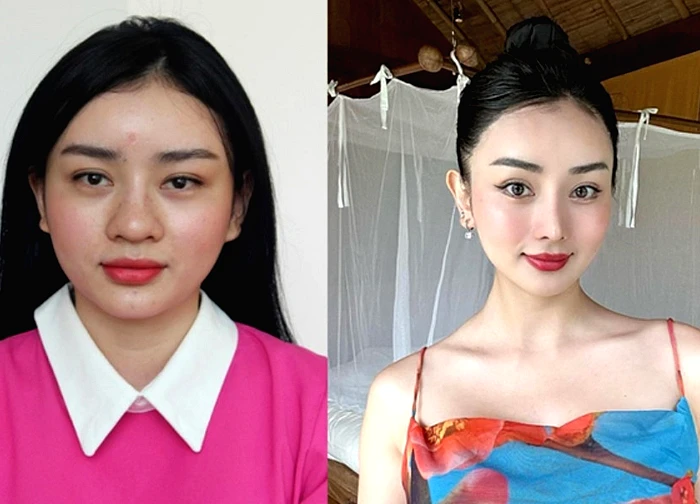 5 cô gái Việt là "nhân chứng" cho sự thay đổi cuộc sống nhờ "dao kéo": Đẹp, giàu, bản sao Phạm Băng Băng