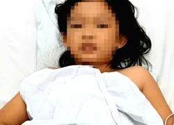 Cứu sống bệnh nhi 9 tuổi bị ngộ độc ốc biển chưa rõ danh tính