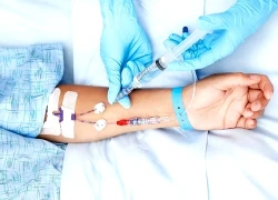 Phát hiện ca mắc hội chứng tiền ung thư "hiểm", chưa có cách trị thống nhất