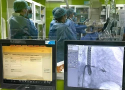 Căn bệnh có số ca tử vong cao hơn ung thư, 4 người trưởng thành có một ca mắc