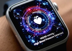 Apple Watch tích hợp AI phát hiện nguy cơ cao huyết áp