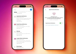 Người dùng Apple Watch đã có thể sử dụng tính năng cảnh báo huyết áp