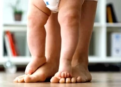 Nguyên nhân khiến trẻ bị còi xương