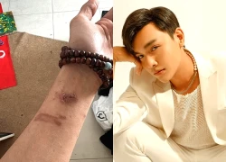 Diễn viên Hữu Tài gặp sự cố hỏa hoạn