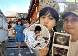 Kang Eun Bi nhập viện khẩn cấp khi mang thai, tình trạng khiến fan bàng hoàng