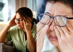 Đột quỵ não giai đoạn sớm không phải đau đầu, mà là 4 dấu hiệu này