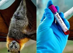 Virus Nipah gây bệnh gì, nguy hiểm như thế nào?