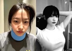 Nữ ca sĩ bị gãy cổ trong lúc tập luyện, người hâm mộ bàng hoàng