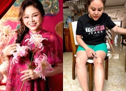 Tình trạng của diễn viên Lê Giang