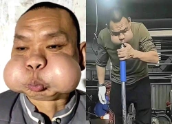 30 năm thổi thủy tinh, gương mặt biến dạng: Nghệ nhân Trung Quốc có đôi má phồng như "ếch", cái giá không ai muốn trả