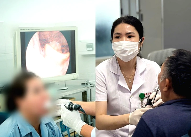 Ngậm vitamin C chữa hóc xương, một phụ nữ suýt tử vong