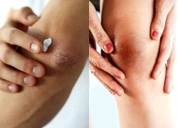 Bí quyết làm sáng các vùng da khó nhằn không phải ai cũng biết