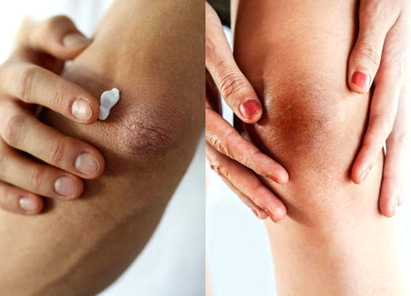 Bí quyết làm sáng các vùng da khó nhằn không phải ai cũng biết