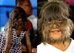 Cô bé "người sói" hiện ra sao?