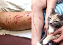 Người đàn ông tử vong sau khi bị mèo cào