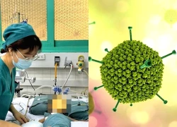Loại virus quen thuộc khiến trẻ viêm phổi nặng, đe dọa tính mạng