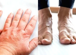 Một bộ phận càng to nguy cơ bệnh tật càng lớn