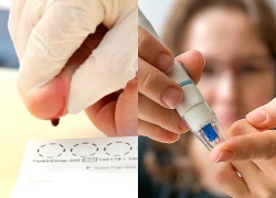 Phát hiện sớm bệnh Alzheimer từ lấy máu đầu ngón tay