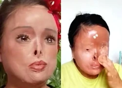 Trung Quốc: Bị chồng cũ tạt axit gây biến dạng, người phụ nữ tự vẽ lại mặt