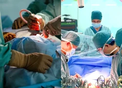 Ca phẫu thuật "khó chồng khó" cứu bé gái mắc dị tật hiếm gặp