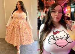 Cô gái khổ vì bộ ngực nặng 25kg làm cột sống bị vẹo, xin thu nhỏ không được