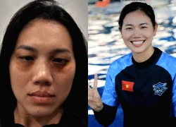 Dụi mắt không nhận ra Ánh Viên, sao lại ra nông nỗi này?