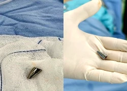 Kịp thời cứu sống bé 7 tuổi hóc ngòi bút rơi vào đường thở